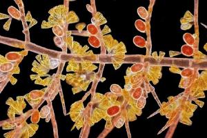 Mikroskopisk foto af en rødalge.